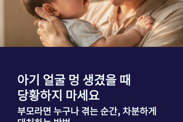 아기 얼굴 멍 원인과 대처법, 갑자기 멍 생겼을 때 1초 안에 확인할 것들