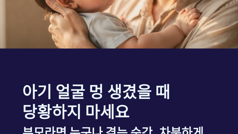 아기 얼굴 멍 원인과 대처법, 갑자기 멍 생겼을 때 1초 안에 확인할 것들